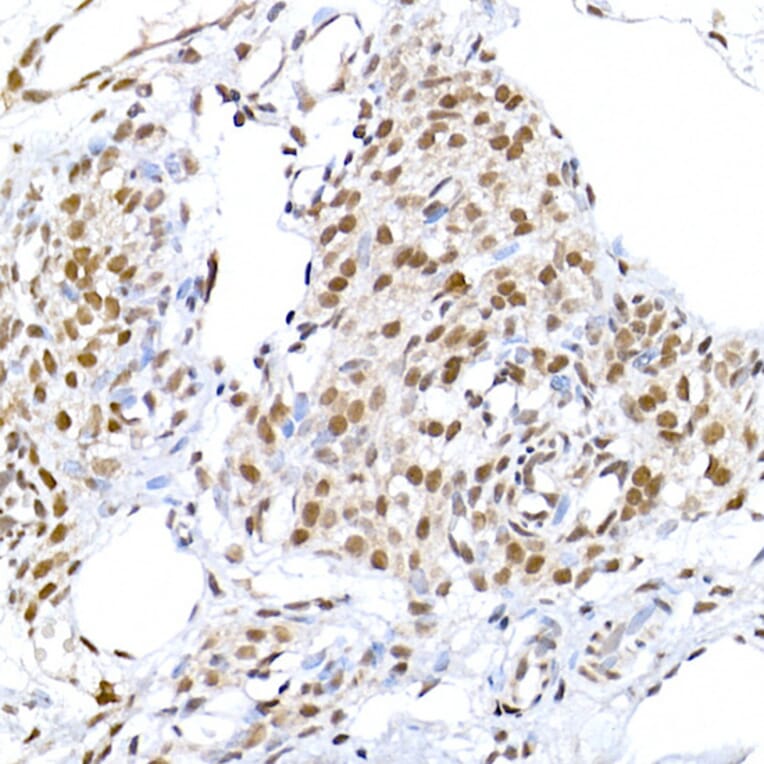 Immunohistochemistry - Anti-DNA Ligase III/LIG3 Antibody (A87920) - Antibodies.com