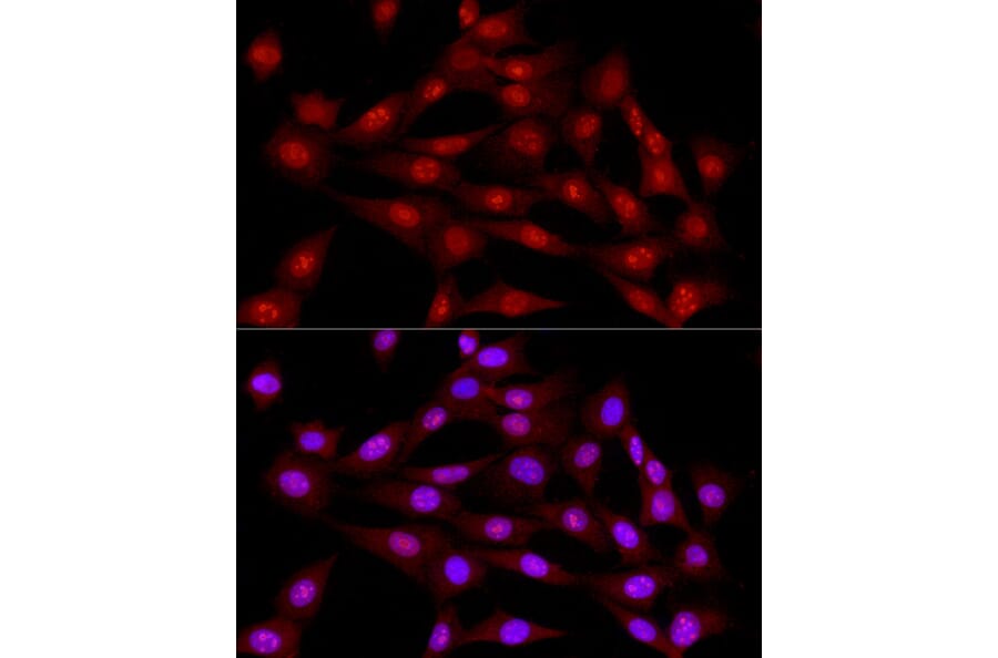 Immunofluorescence - Anti-DNA Ligase III/LIG3 Antibody (A87920) - Antibodies.com