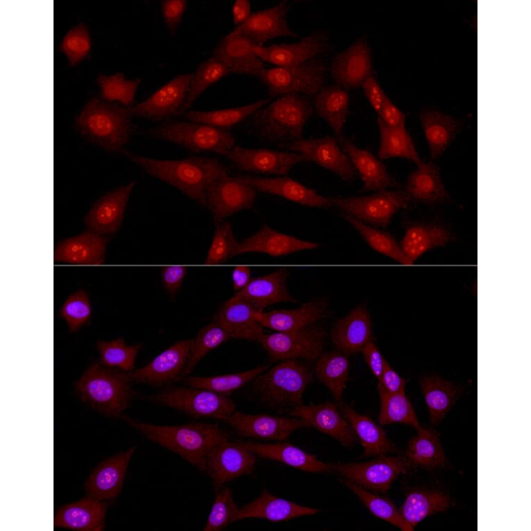 Immunofluorescence - Anti-DNA Ligase III/LIG3 Antibody (A87920) - Antibodies.com
