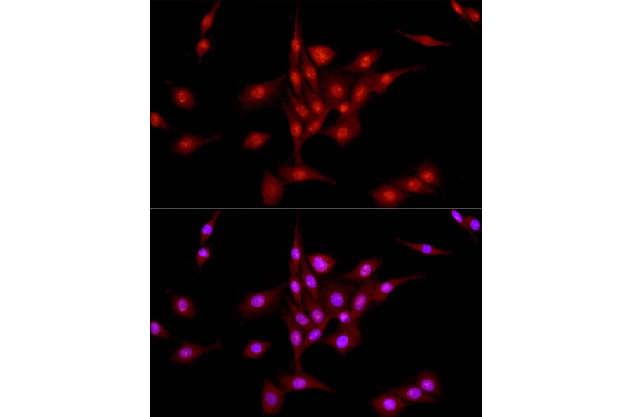 Immunofluorescence - Anti-DNA Ligase III/LIG3 Antibody (A87920) - Antibodies.com