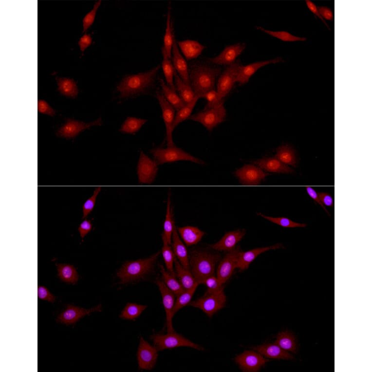 Immunofluorescence - Anti-DNA Ligase III/LIG3 Antibody (A87920) - Antibodies.com