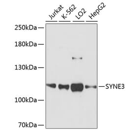 Western Blot - Anti-Nesprin3 Antibody (A87921) - Antibodies.com