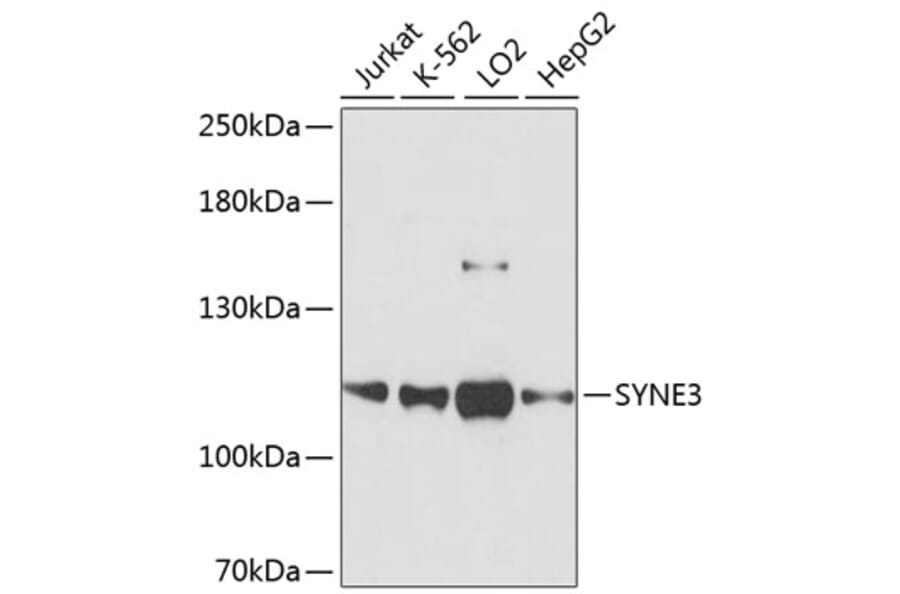 Western Blot - Anti-Nesprin3 Antibody (A87921) - Antibodies.com