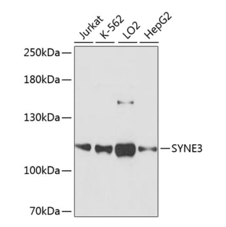 Western Blot - Anti-Nesprin3 Antibody (A87921) - Antibodies.com