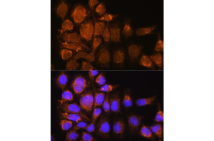 Immunofluorescence - Anti-Nesprin3 Antibody (A87921) - Antibodies.com