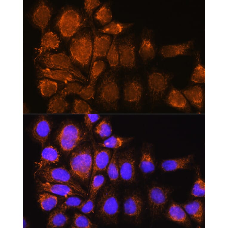 Immunofluorescence - Anti-Nesprin3 Antibody (A87921) - Antibodies.com