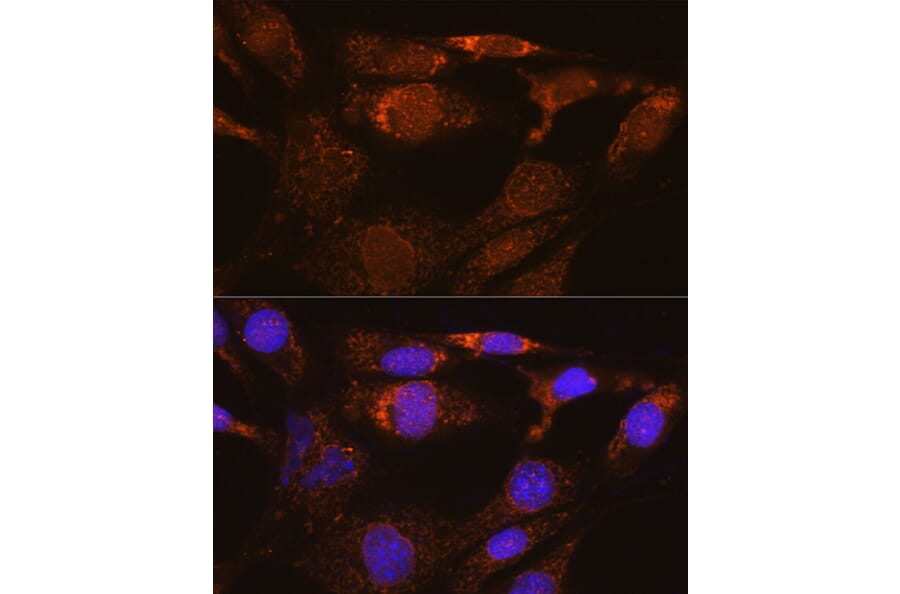 Immunofluorescence - Anti-Nesprin3 Antibody (A87921) - Antibodies.com