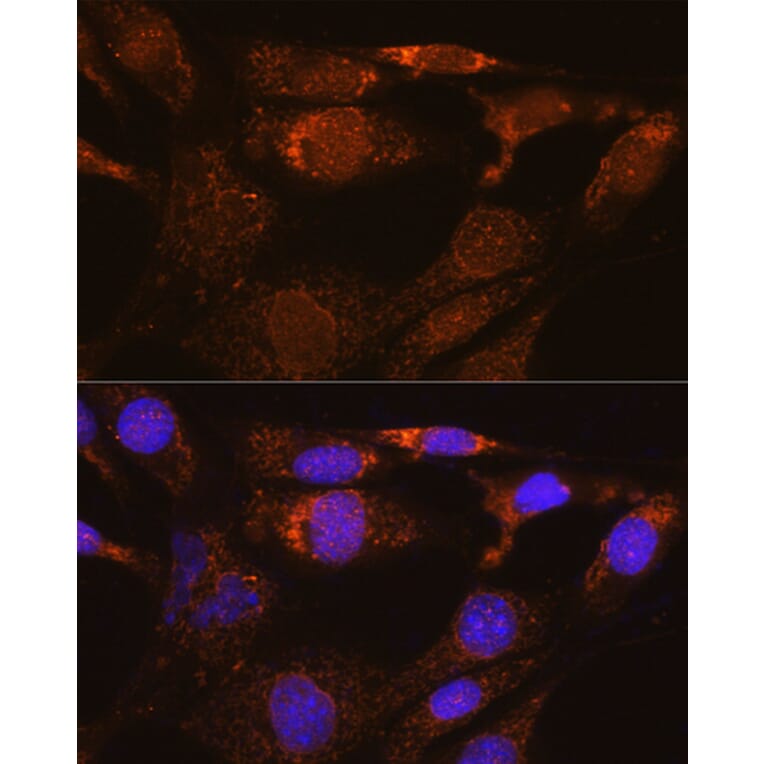 Immunofluorescence - Anti-Nesprin3 Antibody (A87921) - Antibodies.com