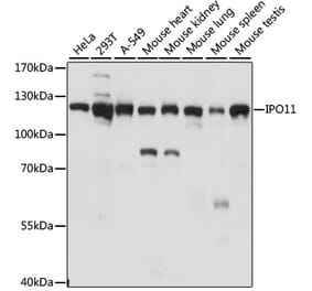Western Blot - Anti-IPO11 Antibody (A87922) - Antibodies.com