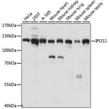 Western Blot - Anti-IPO11 Antibody (A87922) - Antibodies.com