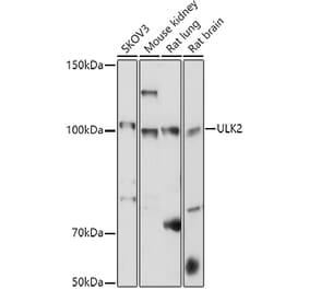 Western Blot - Anti-ULK2 Antibody (A87923) - Antibodies.com