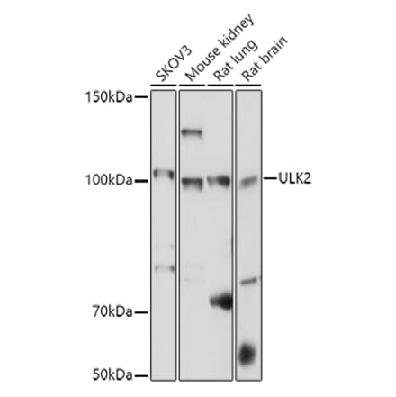 Western Blot - Anti-ULK2 Antibody (A87923) - Antibodies.com