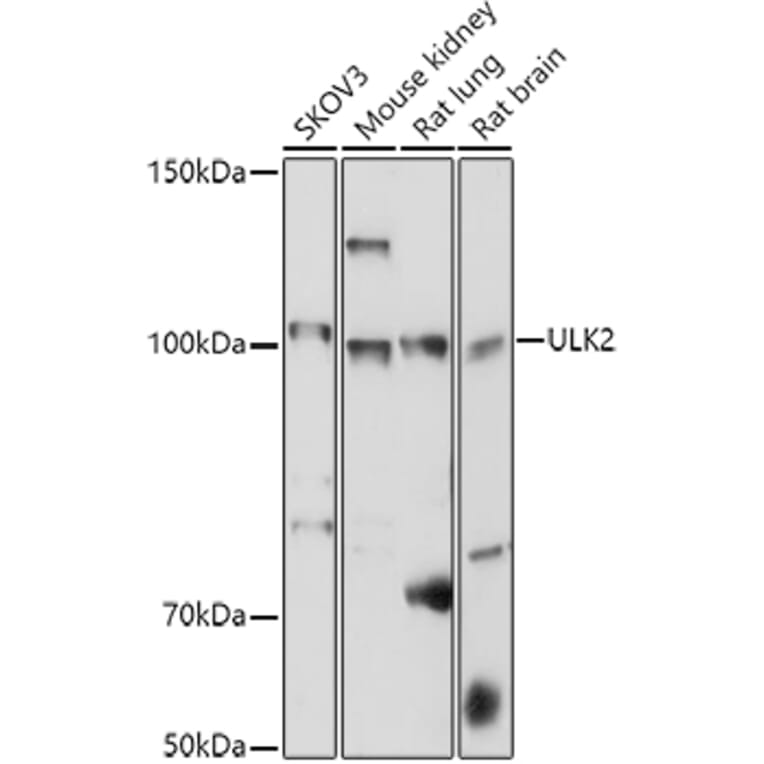 Western Blot - Anti-ULK2 Antibody (A87923) - Antibodies.com