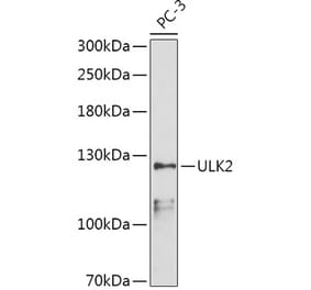 Western Blot - Anti-ULK2 Antibody (A87924) - Antibodies.com