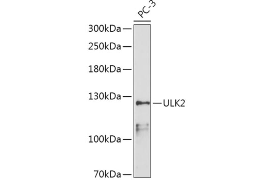 Western Blot - Anti-ULK2 Antibody (A87924) - Antibodies.com
