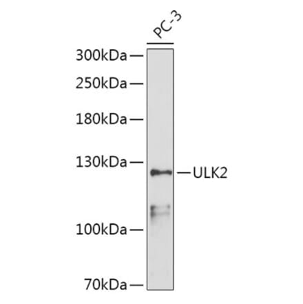 Western Blot - Anti-ULK2 Antibody (A87924) - Antibodies.com