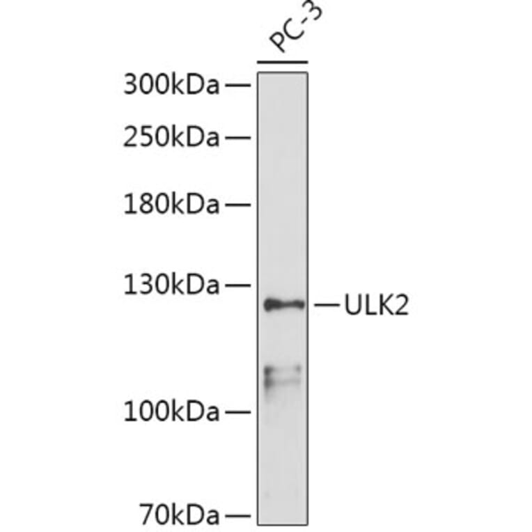 Western Blot - Anti-ULK2 Antibody (A87924) - Antibodies.com