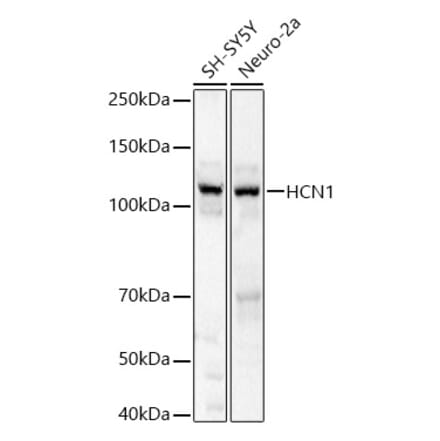 Western Blot - Anti-HCN1 Antibody (A87925) - Antibodies.com