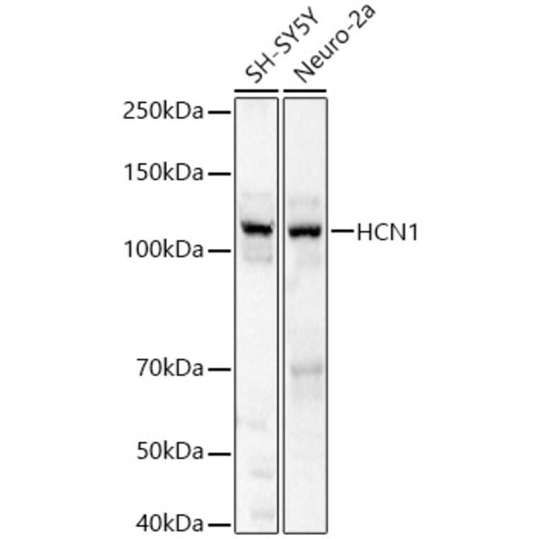 Western Blot - Anti-HCN1 Antibody (A87925) - Antibodies.com