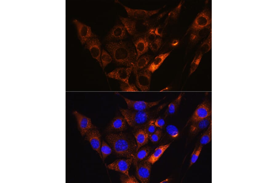 Immunofluorescence - Anti-HCN1 Antibody (A87925) - Antibodies.com