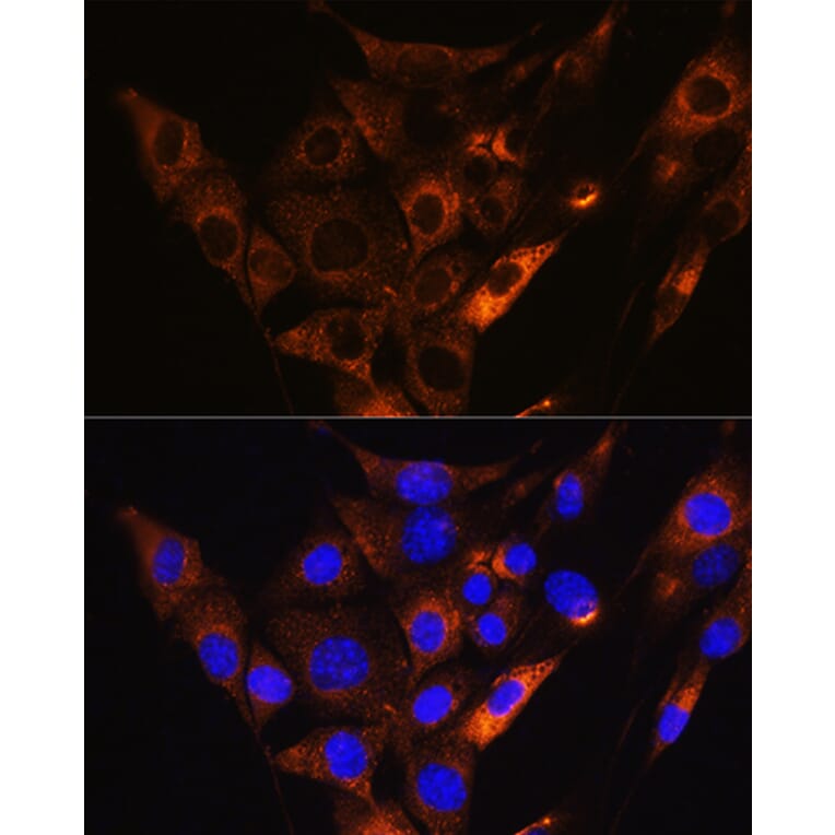 Immunofluorescence - Anti-HCN1 Antibody (A87925) - Antibodies.com