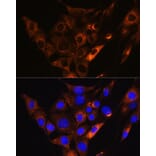 Immunofluorescence - Anti-HCN1 Antibody (A87925) - Antibodies.com