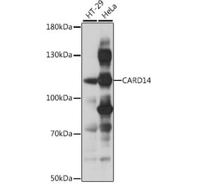 Western Blot - Anti-CARD14 Antibody (A87926) - Antibodies.com