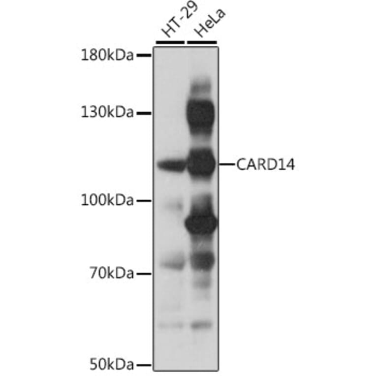 Western Blot - Anti-CARD14 Antibody (A87926) - Antibodies.com