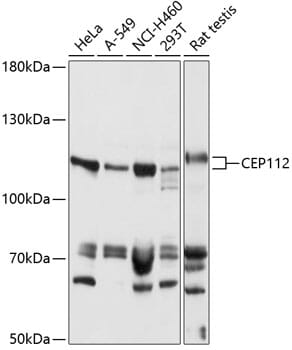 Western blot analysis of extracts of various cell lines, using Anti-CEP112 Antibody (A14302) at 1:1,000 dilution.
Secondary antibody: Goat Anti-Rabbit IgG (H+L) (HRP) (AS014) at 1:10,000 dilution.
Lysates / proteins: 25µg per lane.
Blocking buffer: 3% non-fat dry milk in TBST.
Detection: ECL Basic Kit (RM00020).
Exposure time: 60s.