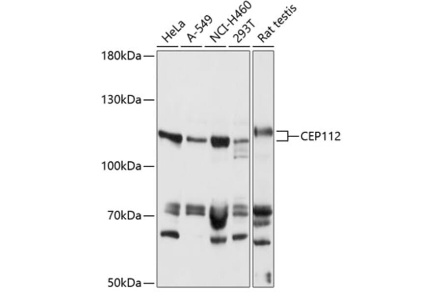 Western Blot - Anti-CEP112 Antibody (A87927) - Antibodies.com