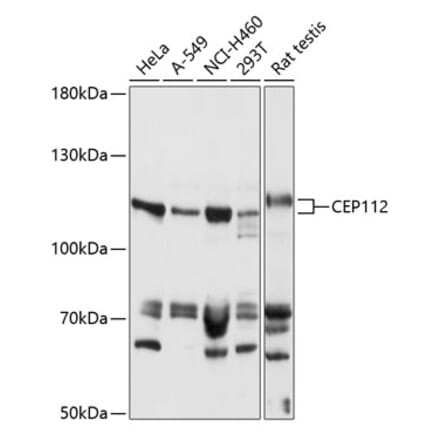 Western Blot - Anti-CEP112 Antibody (A87927) - Antibodies.com