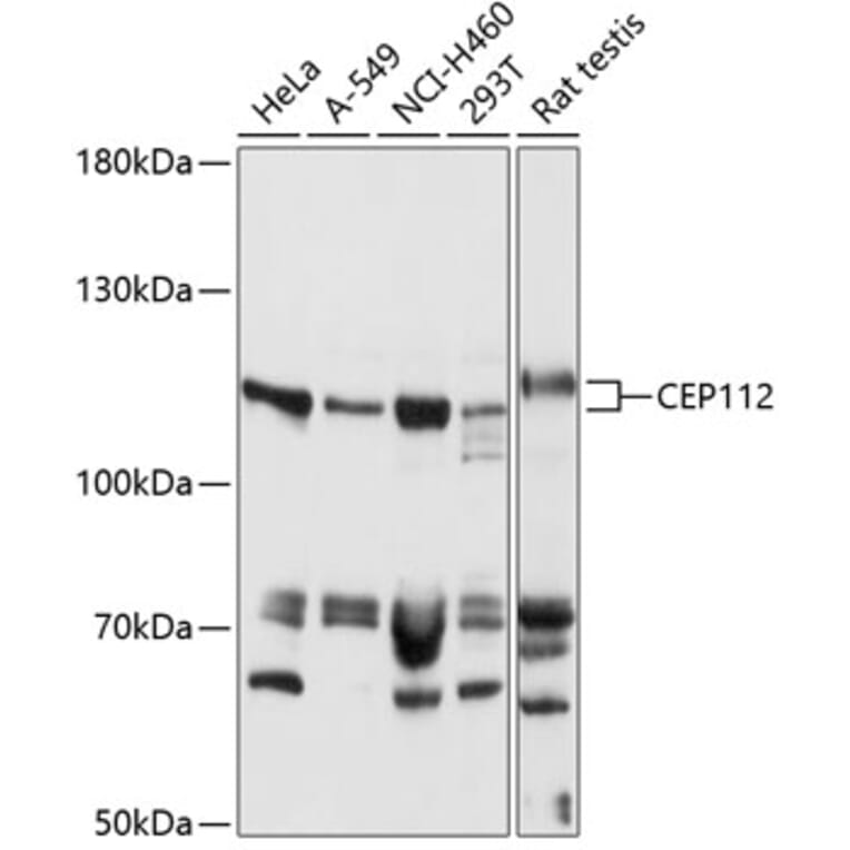 Western Blot - Anti-CEP112 Antibody (A87927) - Antibodies.com