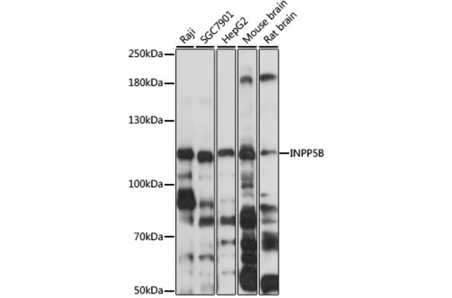 Western Blot - Anti-INPP5B Antibody (A3927) - Antibodies.com