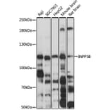 Western Blot - Anti-INPP5B Antibody (A3927) - Antibodies.com