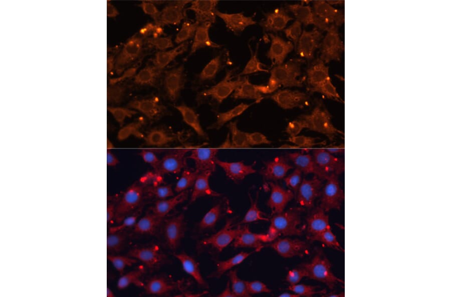Immunofluorescence - Anti-INPP5B Antibody (A3927) - Antibodies.com