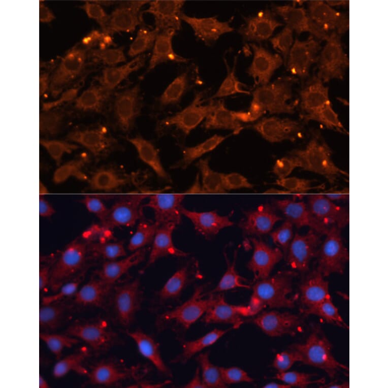 Immunofluorescence - Anti-INPP5B Antibody (A3927) - Antibodies.com
