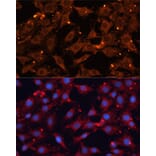 Immunofluorescence - Anti-INPP5B Antibody (A3927) - Antibodies.com