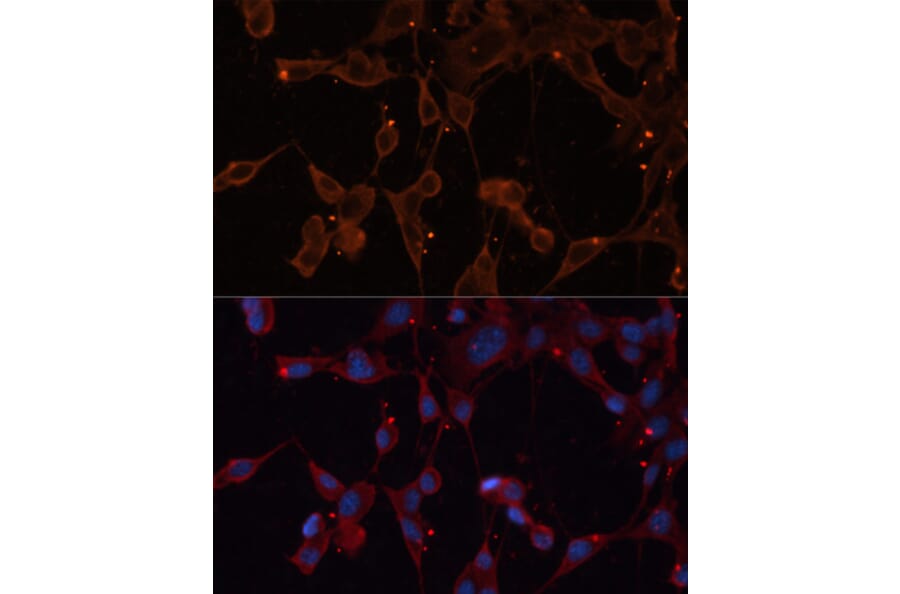 Immunofluorescence - Anti-INPP5B Antibody (A3927) - Antibodies.com