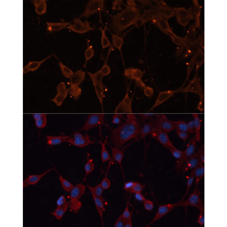 Immunofluorescence - Anti-INPP5B Antibody (A3927) - Antibodies.com