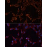 Immunofluorescence - Anti-INPP5B Antibody (A3927) - Antibodies.com