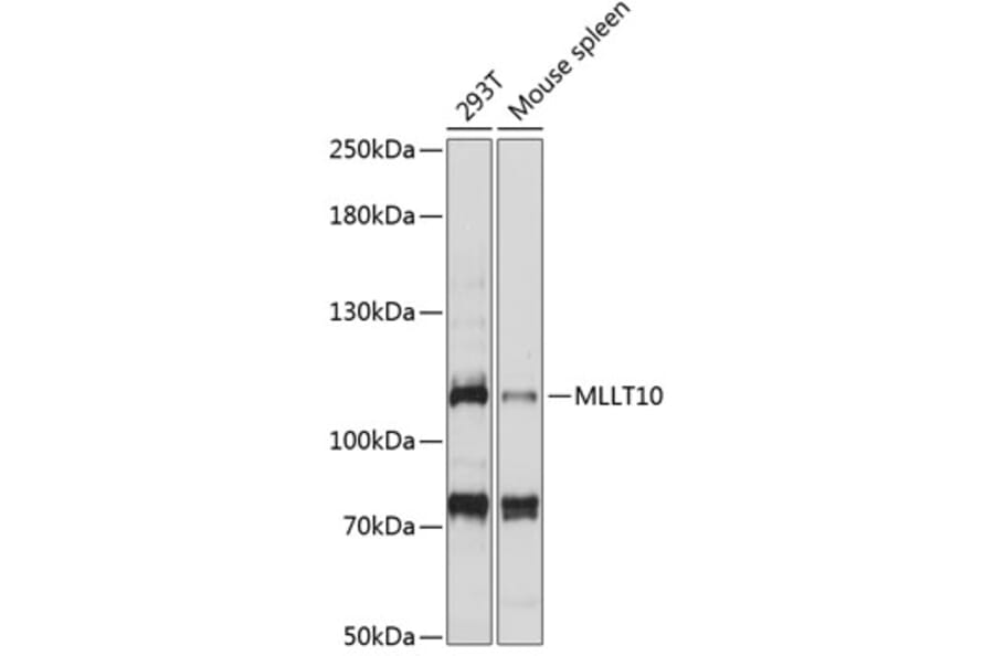 Western Blot - Anti-AF10 Antibody (A87930) - Antibodies.com