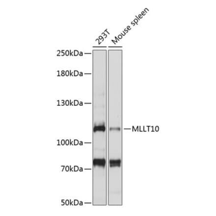 Western Blot - Anti-AF10 Antibody (A87930) - Antibodies.com