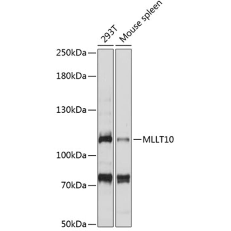 Western Blot - Anti-AF10 Antibody (A87930) - Antibodies.com
