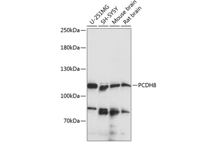 Western Blot - Anti-PCDH8 Antibody (A87931) - Antibodies.com