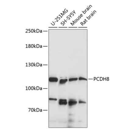 Western Blot - Anti-PCDH8 Antibody (A87931) - Antibodies.com