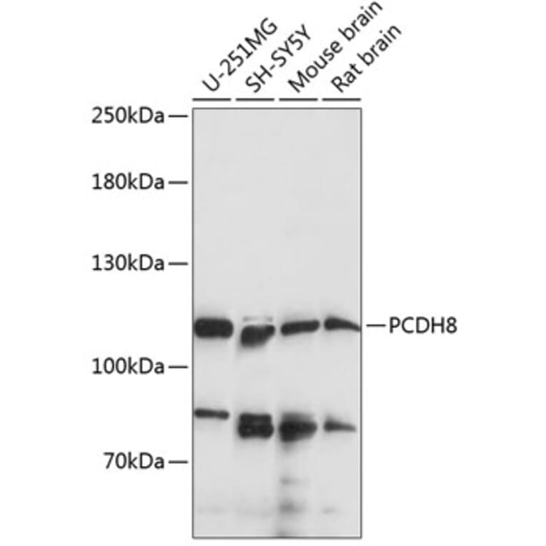 Western Blot - Anti-PCDH8 Antibody (A87931) - Antibodies.com