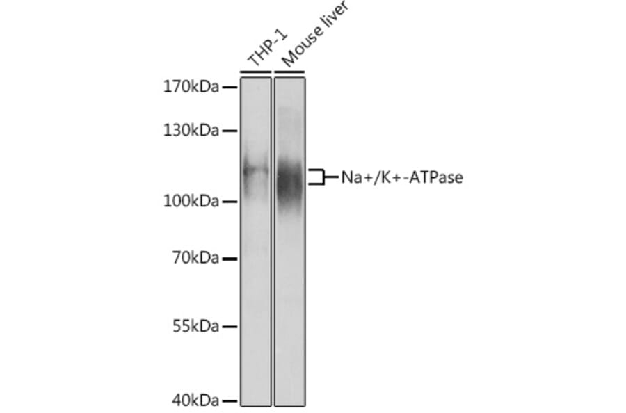 Western Blot - Anti-Sodium Potassium ATPase Antibody (A87932) - Antibodies.com