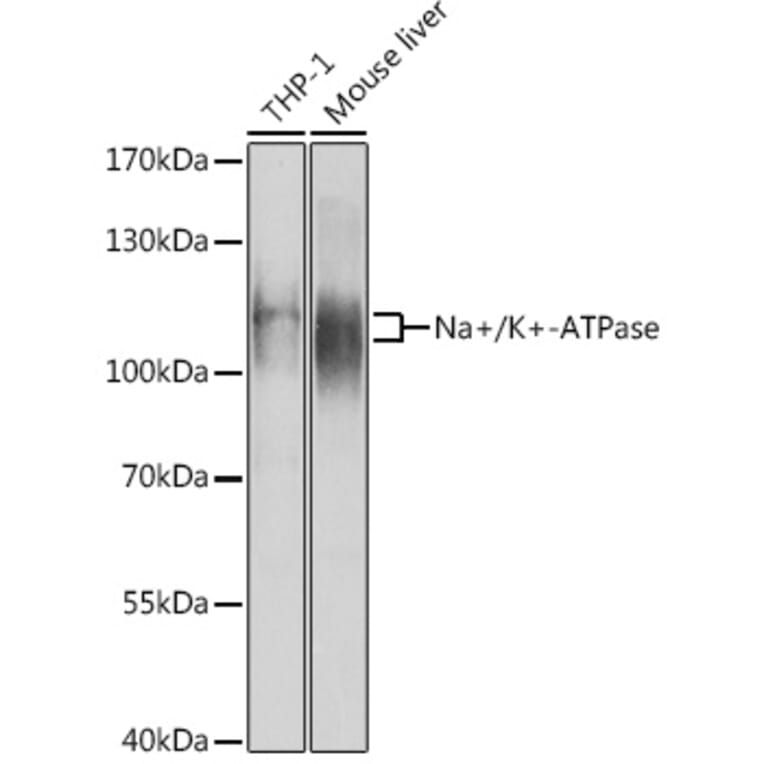 Western Blot - Anti-Sodium Potassium ATPase Antibody (A87932) - Antibodies.com