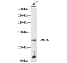 Western Blot - Anti-RBM26 Antibody (A87933) - Antibodies.com
