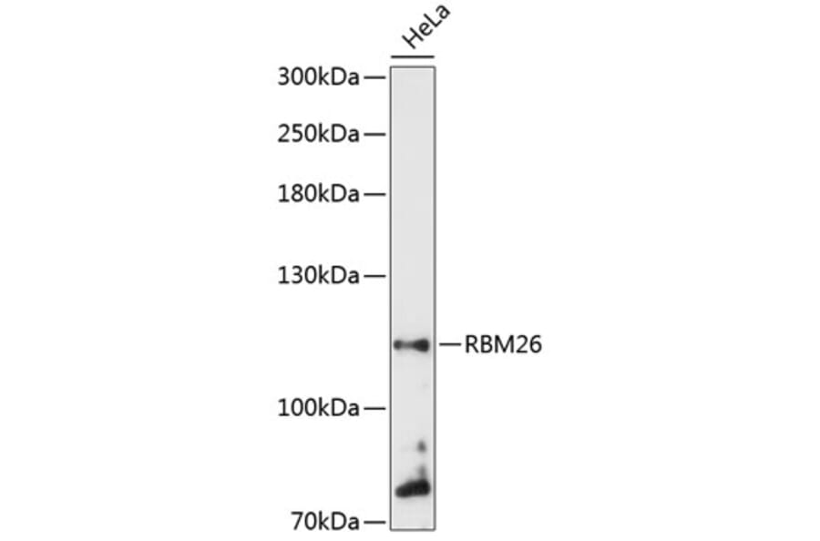 Western Blot - Anti-RBM26 Antibody (A87933) - Antibodies.com